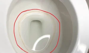 How to Get Rid of Toilet Ring